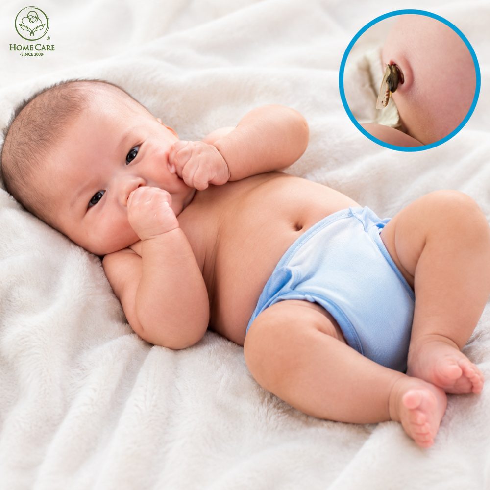 Giữ rốn bé khô và thông thoáng