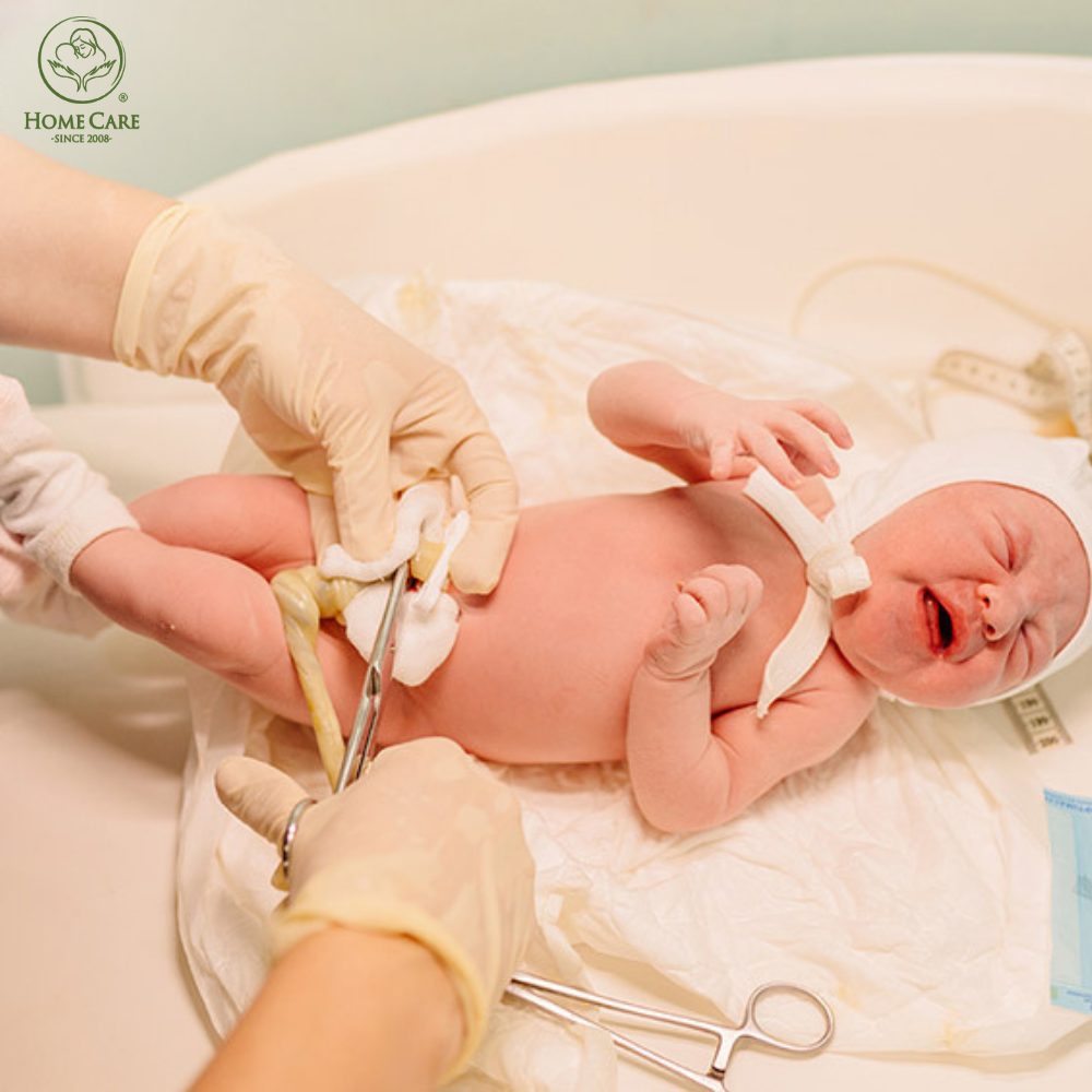 Vì sao cần phải vệ sinh rốn cho trẻ sơ sinh?